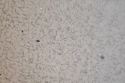 Обнаружение фазы золота-500 раз фаза золота